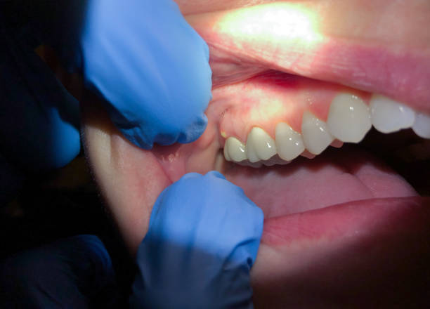 Best Walk-In Emergency Dentist in Pleasant Valley, MO